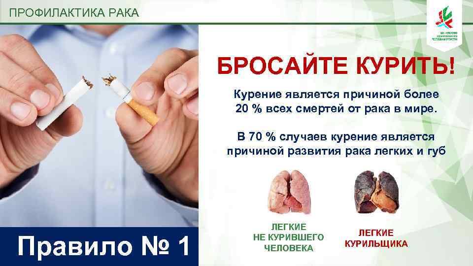 ПРОФИЛАКТИКА РАКА БРОСАЙТЕ КУРИТЬ! Курение является причиной более 20 % всех смертей от рака