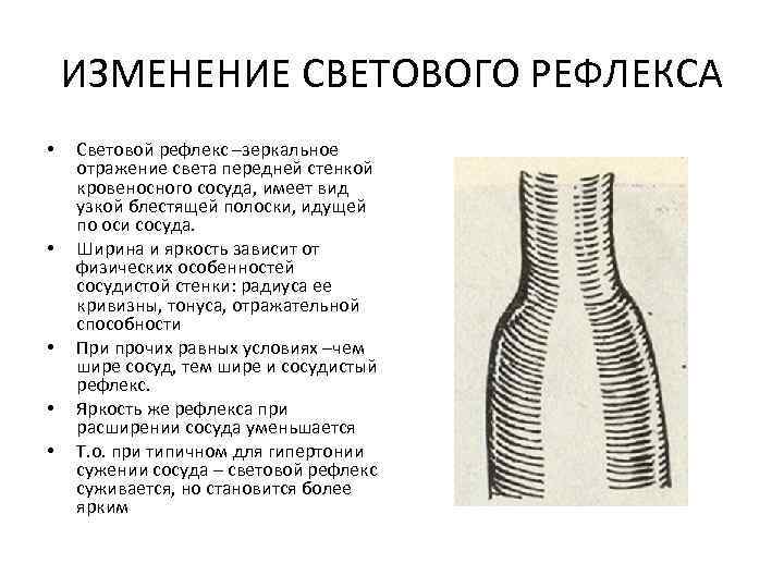 ИЗМЕНЕНИЕ СВЕТОВОГО РЕФЛЕКСА • • • Световой рефлекс –зеркальное отражение света передней стенкой кровеносного