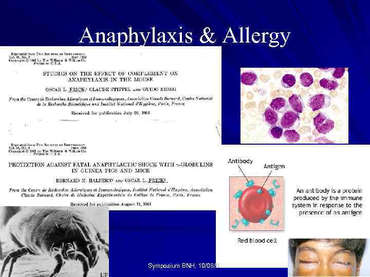 Anaphylaxis & Allergy Symposium BNH, 10/08/04 19 