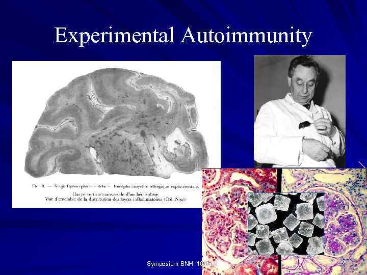 Experimental Autoimmunity Symposium BNH, 10/08/04 22 