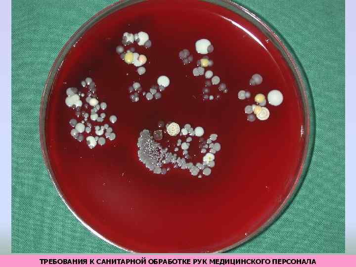 ТРЕБОВАНИЯ К САНИТАРНОЙ ОБРАБОТКЕ РУК МЕДИЦИНСКОГО ПЕРСОНАЛА 
