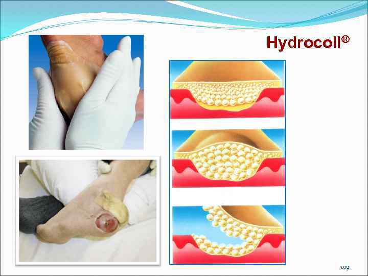 Hydrocoll® 109 