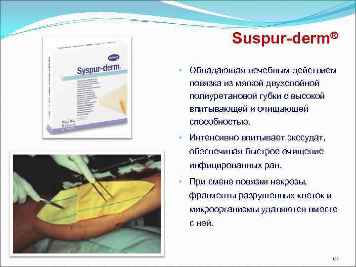 Suspur-derm® • Обладающая лечебным действием повязка из мягкой двухслойной полиуретановой губки с высокой впитывающей