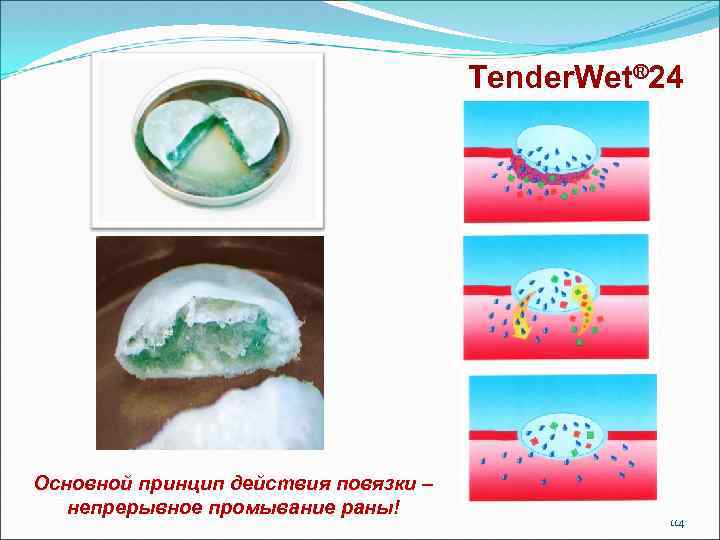 Tender. Wet® 24 Основной принцип действия повязки – непрерывное промывание раны! 114 