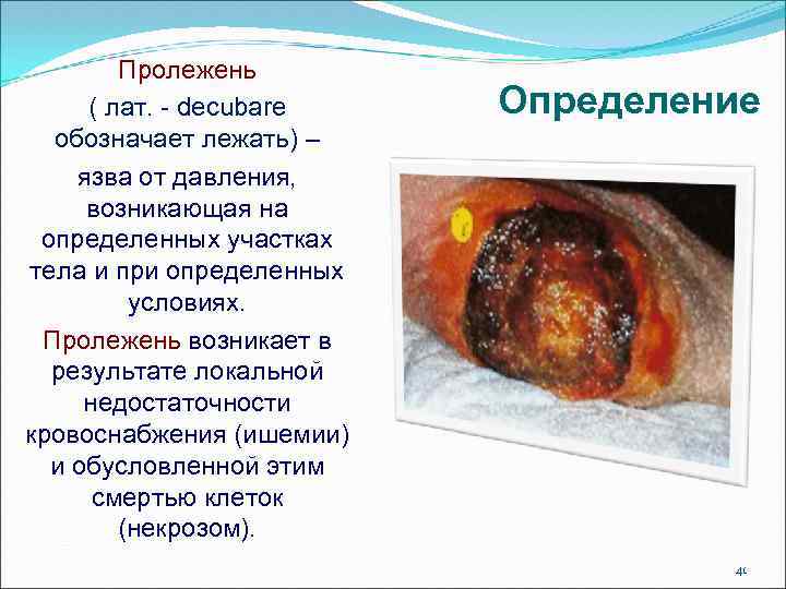 Пролежень ( лат. - decubare обозначает лежать) – язва от давления, возникающая на определенных