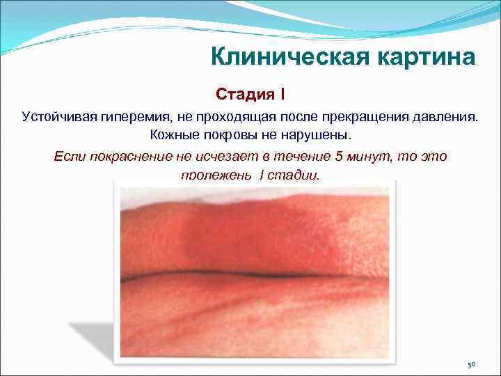 Личная гигиена пациента картинки