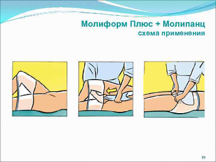 Молиформ Плюс + Молипанц схема применения 93 