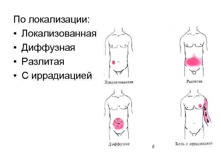 По локализации: • Локализованная • Диффузная • Разлитая • С иррадиацией 