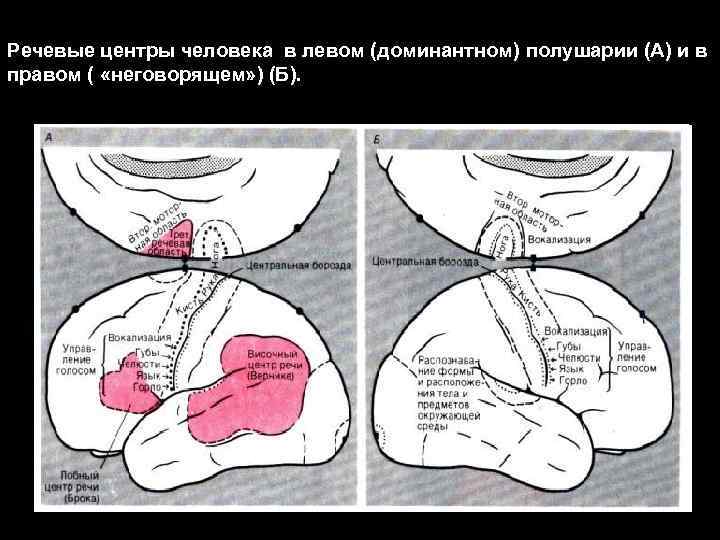 Речевые центры человека в левом (доминантном) полушарии (А) и в правом ( «неговорящем» )