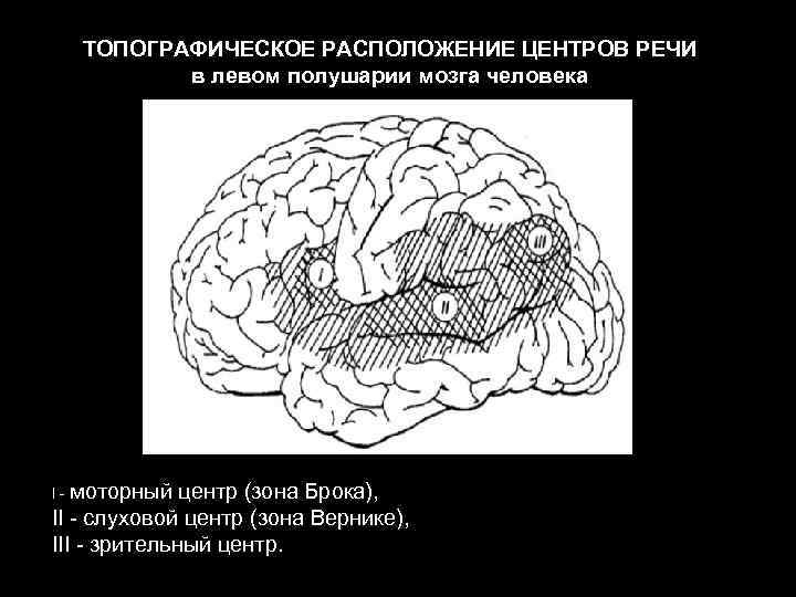 ТОПОГРАФИЧЕСКОЕ РАСПОЛОЖЕНИЕ ЦЕНТРОВ РЕЧИ в левом полушарии мозга человека I - моторный центр (зона