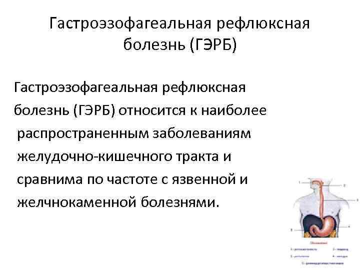 Гастроэзофагеальная рефлюксная болезнь (ГЭРБ) относится к наиболее распространенным заболеваниям желудочно-кишечного тракта и сравнима по