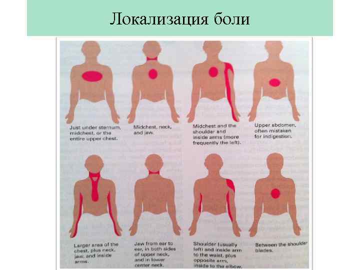 Локализация боли 