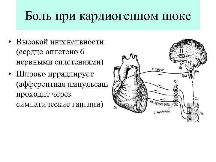 Боль при кардиогенном шоке • Высокой интенсивности (сердце оплетено 6 нервными сплетениями) • Широко