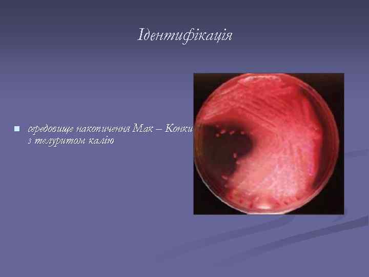 Ідентифікація n середовище накопичення Мак – Конки з телуритом калію 