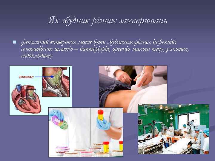 Як збудник різних захворювань n фекальний ентерокок може бути збудником різних інфекцій: сечовивідних шляхів