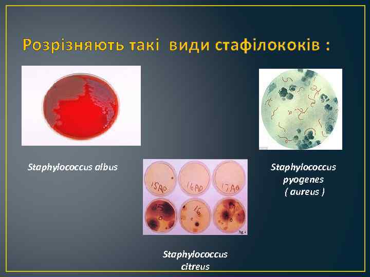 Розрізняють такі види стафілококів : Staphylococcus albus Staphylococcus pyogenes ( aureus ) Staphylococcus citreus