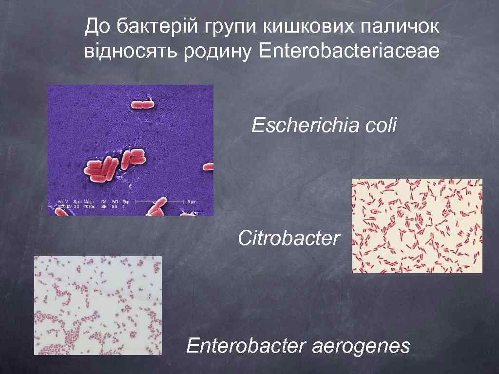 До бактерій групи кишкових паличок відносять родину Enterobacteriaceae Escherichia coli Citrobacter Enterobacter aerogenes 