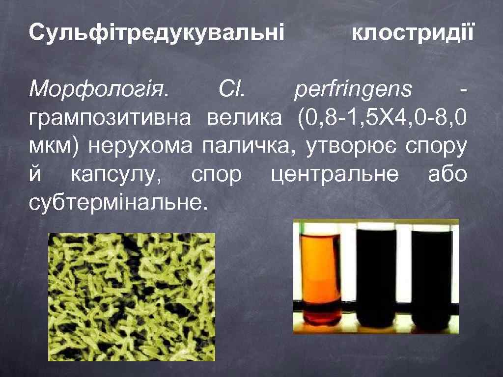 Сульфітредукувальні клостридії Морфологія. Cl. perfringens грампозитивна велика (0, 8 -1, 5 X 4, 0