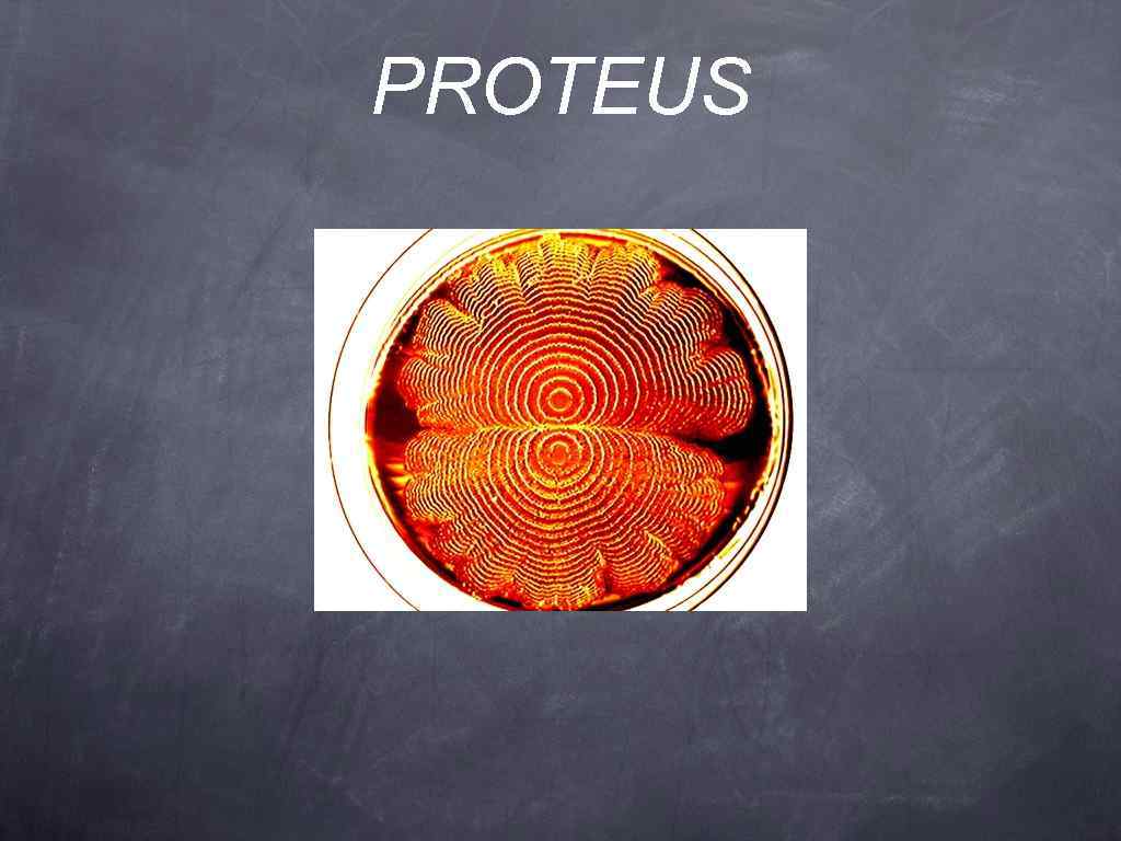 PROTEUS 