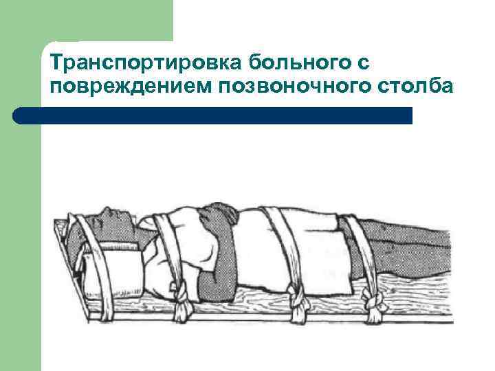 Транспортировка больного с повреждением позвоночного столба 