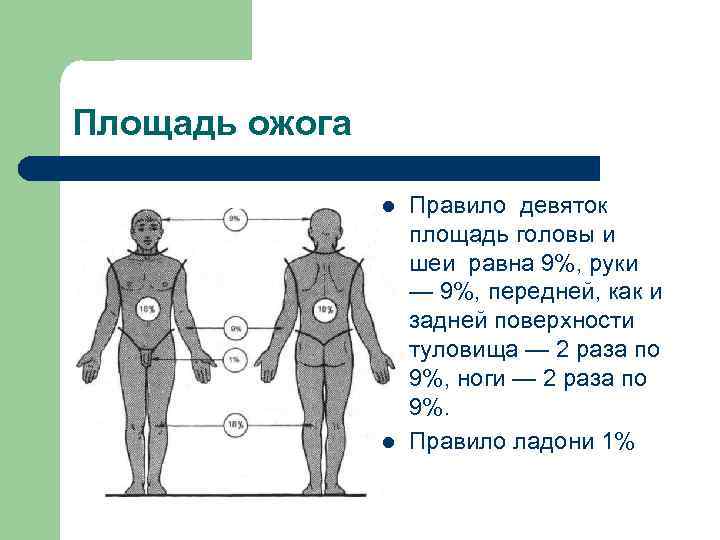 Площадь ожога l l Правило девяток площадь головы и шеи равна 9%, руки —