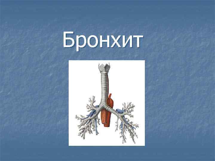 Бронхит 