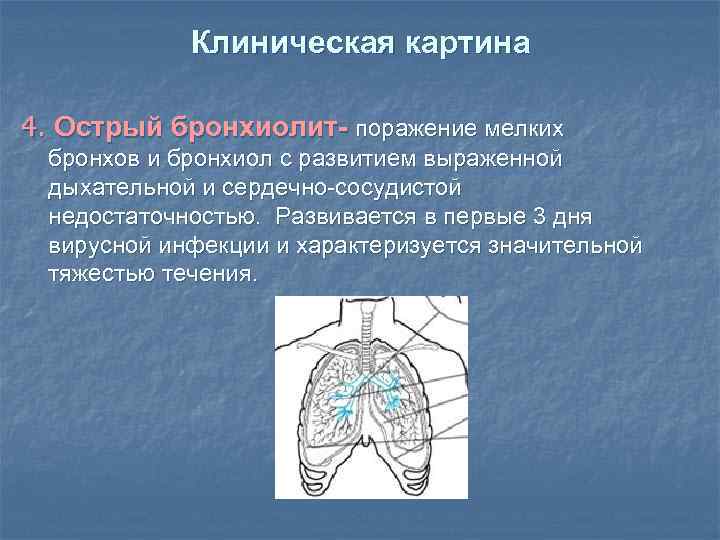 Стенки бронхиол