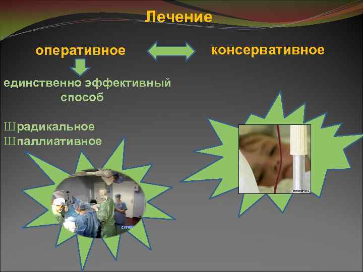 Лечение оперативное консервативное единственно эффективный способ Ш радикальное Ш паллиативное 