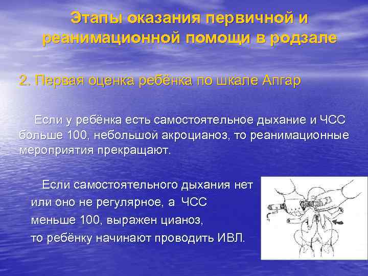 Этапы оказания первичной и реанимационной помощи в родзале 2. Первая оценка ребёнка по шкале