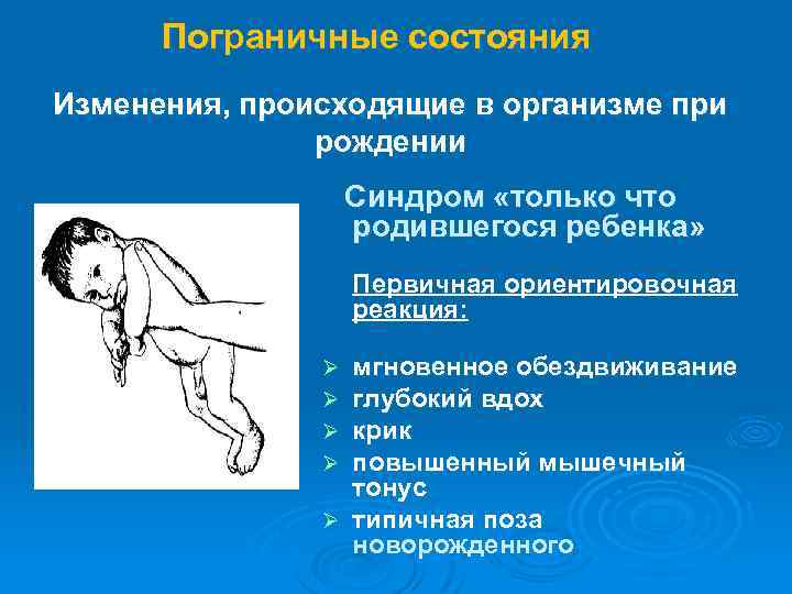 Физиологическая состояния ребенок. Физиологические пограничные состояния новорожденных. Пограничныесостояние новорожденного. Пограничные транзиторные состояния новорожденных. Транзиторные (пограничные) состояния периода новорожденности.