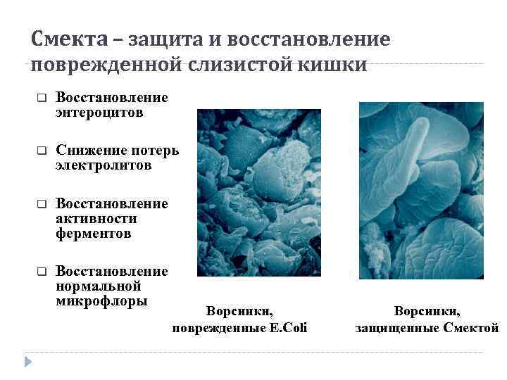 Смекта – защита и восстановление поврежденной слизистой кишки q Восстановление энтероцитов q Снижение потерь