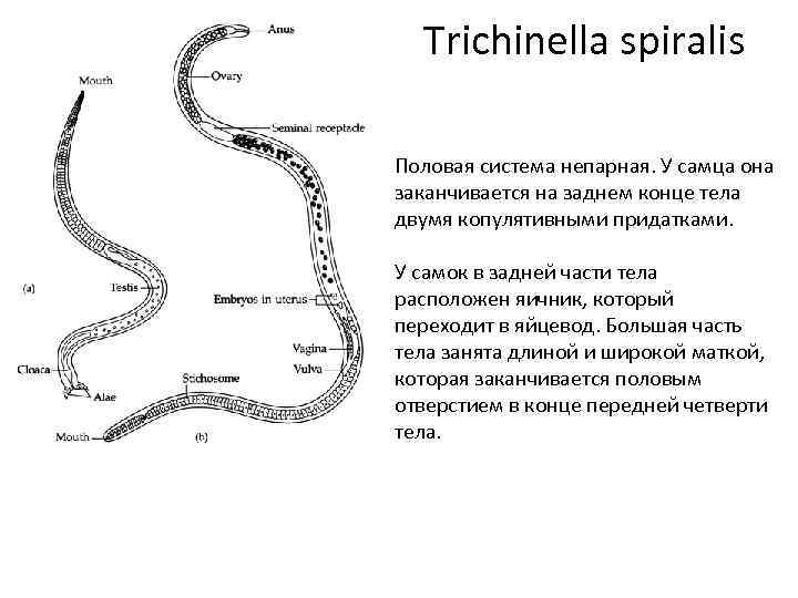 Строение трихинеллы рисунок