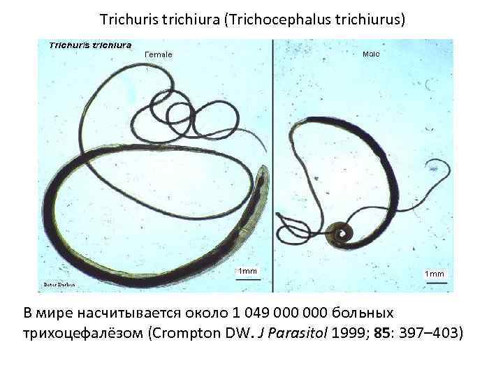 Trichuris trichiura (Trichocephalus trichiurus) В мире насчитывается около 1 049 000 больных трихоцефалёзом (Crompton