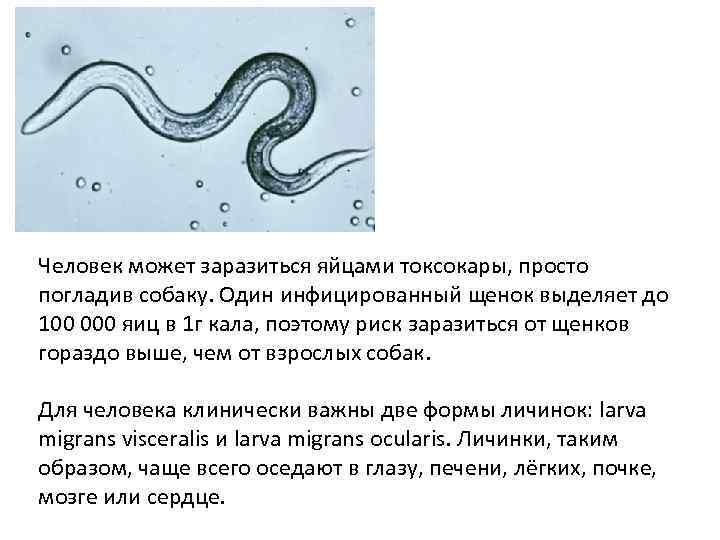 Человек может заразиться яйцами токсокары, просто погладив собаку. Один инфицированный щенок выделяет до 100