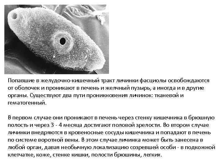 Попавшие в желудочно-кишечный тракт личинки фасциолы освобождаются от оболочек и проникают в печень и