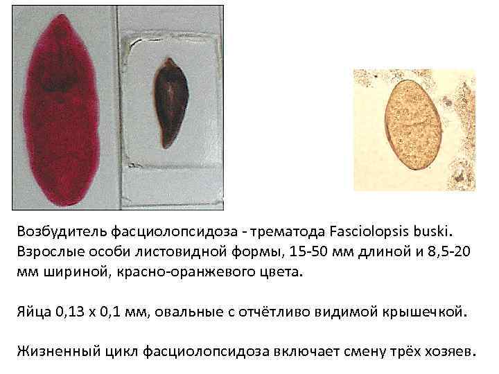 Возбудитель фасциолопсидоза - трематода Fasciolopsis buski. Взрослые особи листовидной формы, 15 -50 мм длиной