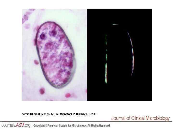 Zarrin-Khameh N et al. J. Clin. Microbiol. 2008; 46: 2137 -2140 
