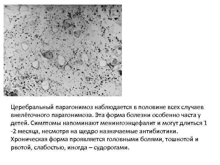 Церебральный парагонимоз наблюдается в половине всех случаев внелёгочного парагонимоза. Эта форма болезни особенно часта