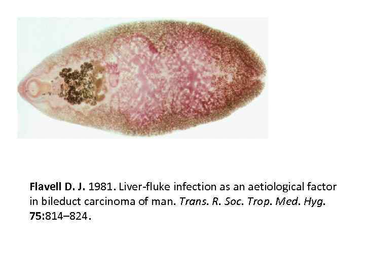 Flavell D. J. 1981. Liver-fluke infection as an aetiological factor in bileduct carcinoma of