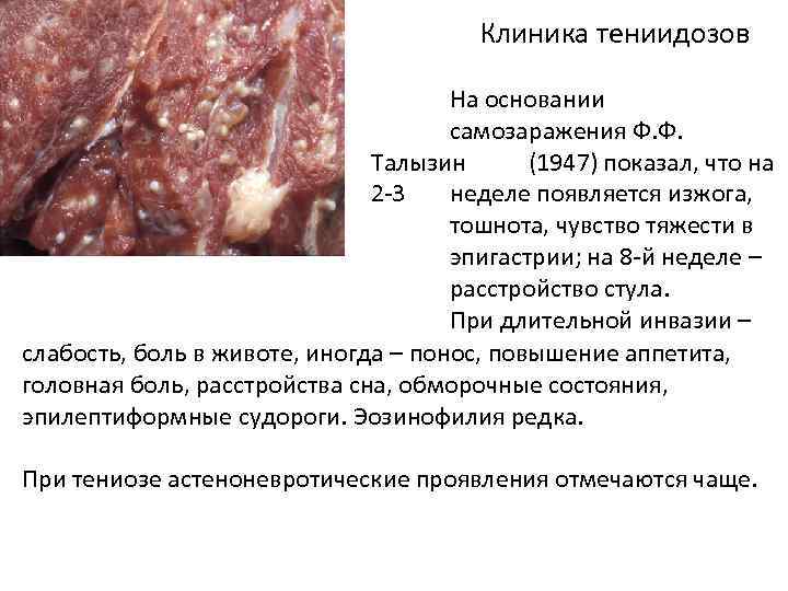 Клиника тениидозов На основании самозаражения Ф. Ф. Талызин (1947) показал, что на 2 -3