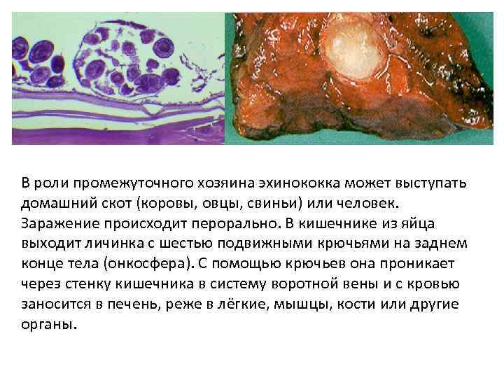 В роли промежуточного хозяина эхинококка может выступать домашний скот (коровы, овцы, свиньи) или человек.