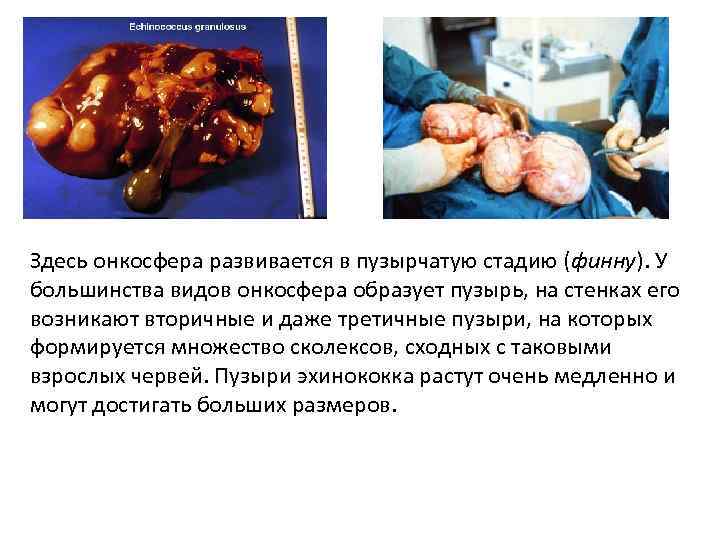 Здесь онкосфера развивается в пузырчатую стадию (финну). У большинства видов онкосфера образует пузырь, на