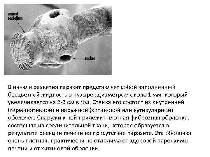 В начале развития паразит представляет собой заполненный бесцветной жидкостью пузырек диаметром около 1 мм,