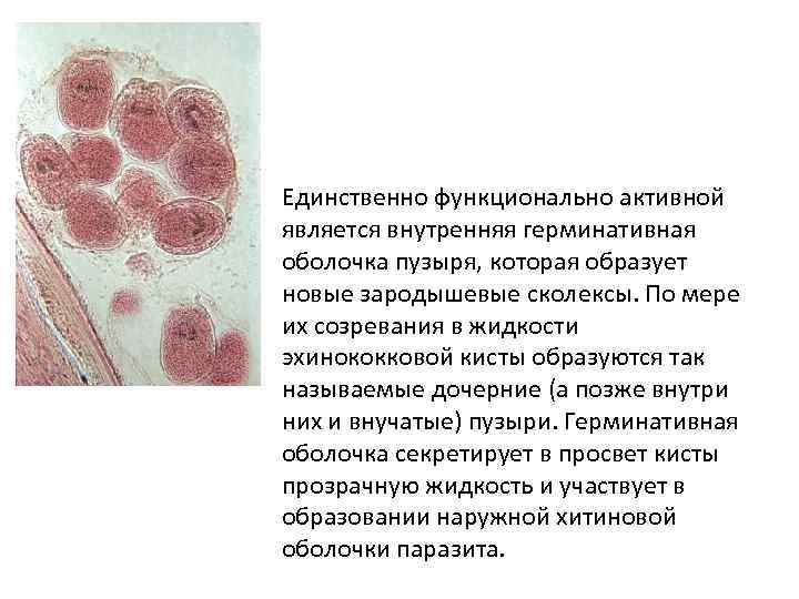 Единственно функционально активной является внутренняя герминативная оболочка пузыря, которая образует новые зародышевые сколексы. По