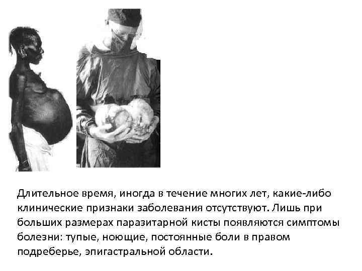 Длительное время, иногда в течение многих лет, какие-либо клинические признаки заболевания отсутствуют. Лишь при