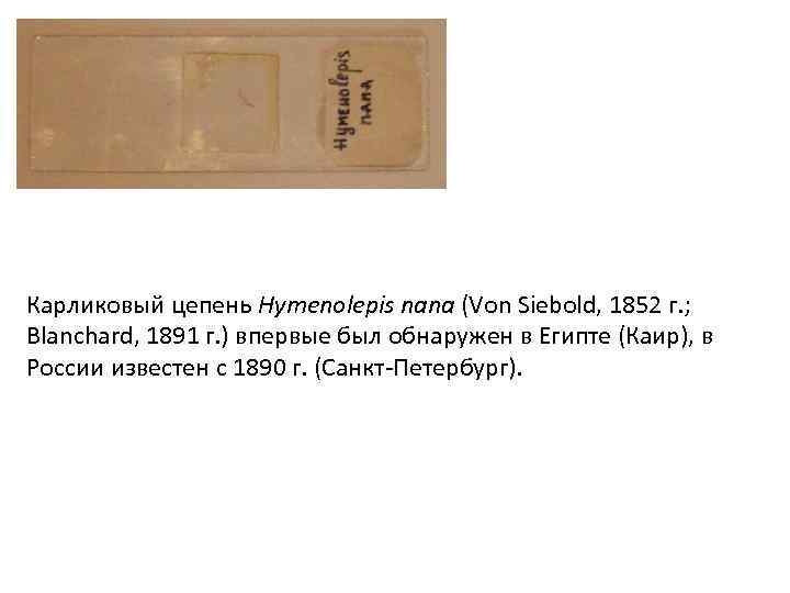 Карликовый цепень Hymenolepis nana (Von Siebold, 1852 г. ; Blanchard, 1891 г. ) впервые