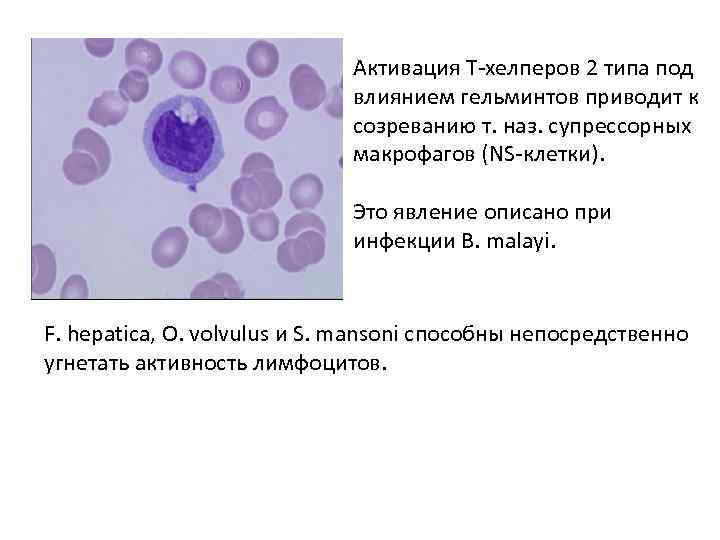 Активация Т-хелперов 2 типа под влиянием гельминтов приводит к созреванию т. наз. супрессорных макрофагов