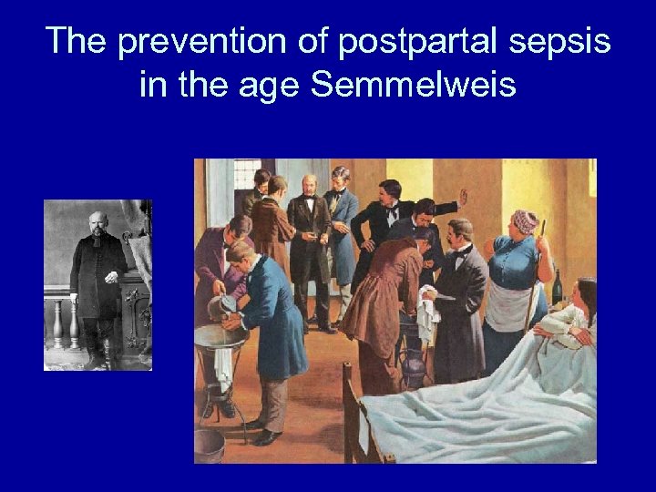 The prevention of postpartal sepsis in the age Semmelweis 