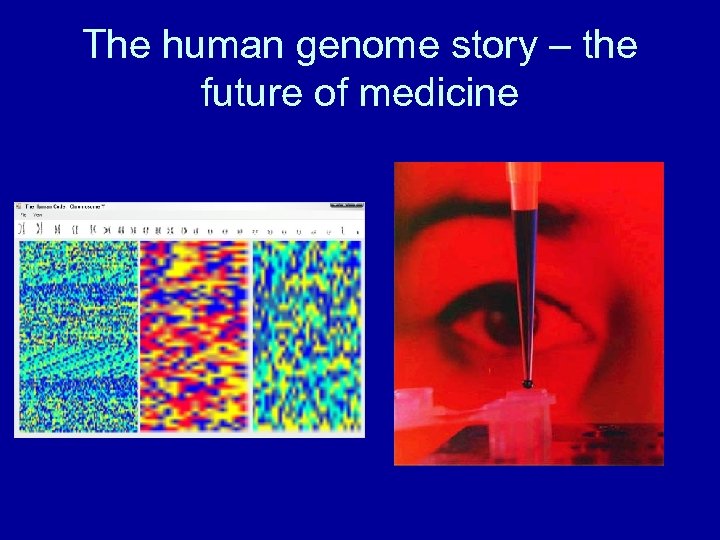 The human genome story – the future of medicine 