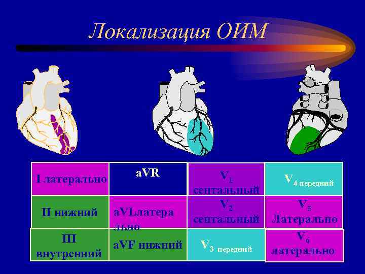 Локализация ОИМ I латерально II нижний a. VR a. VLлатера льно III a. VF